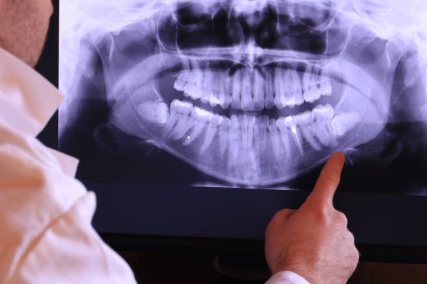 Best Emergency Dental Care for Broken or Chipped Teeth in New Franklin, OH