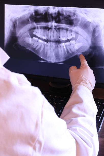 Best Emergency Tooth Extraction in New Franklin, OH